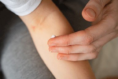 Mão aplica creme hidratante no antebraço de uma pessoa